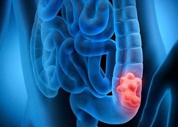 باکتری‌های روده؛ عامل تغییر در میزان کالری دریافتی بدن