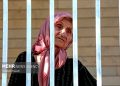 خطر زوال عقل در زنان: تأثیر سندرم تخمدان پلی کیستیک